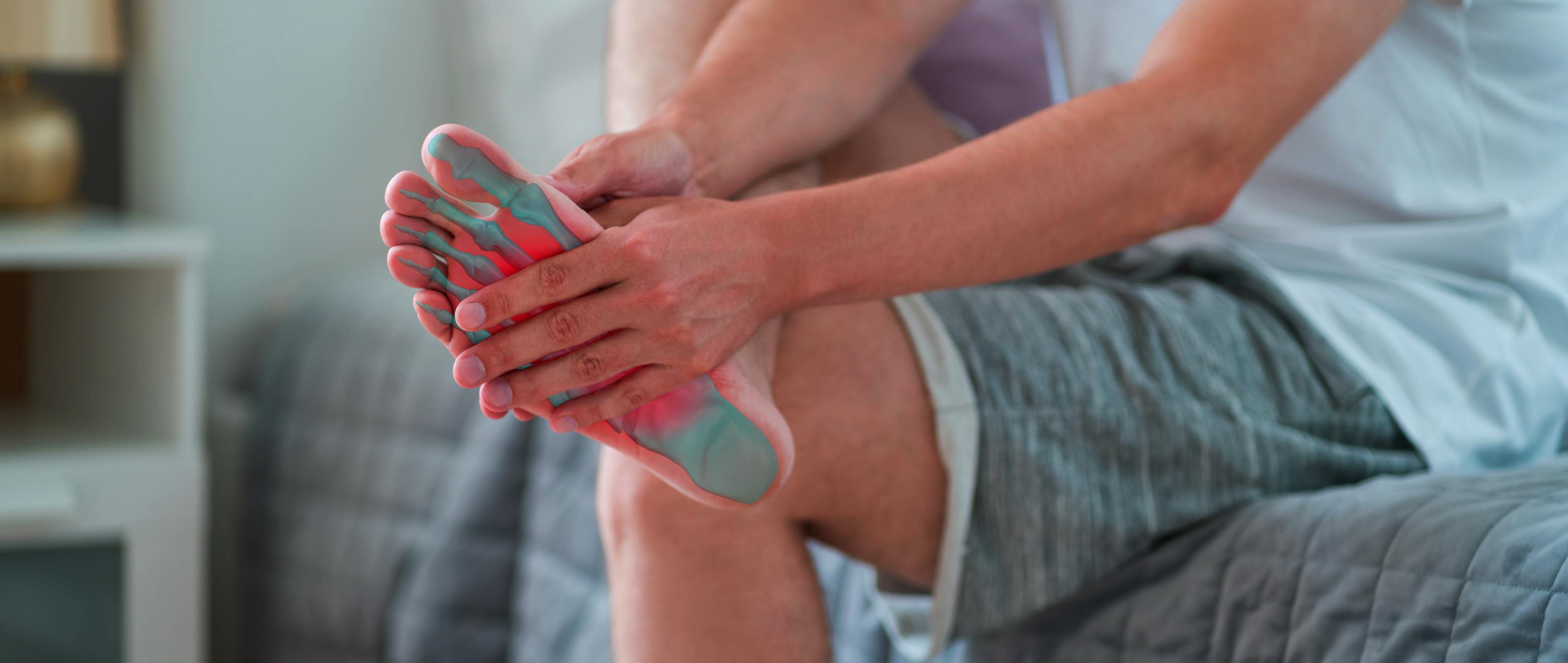 Kick Heel Pain to The Curb: Ways You Can Handle Plantar Fasciitis