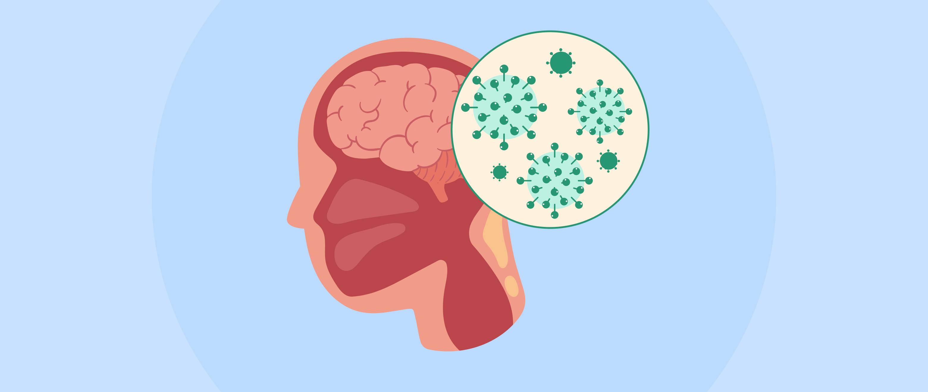 Meningitis Inflames the Brain's Protective Layers: Why Urgent Care is Key