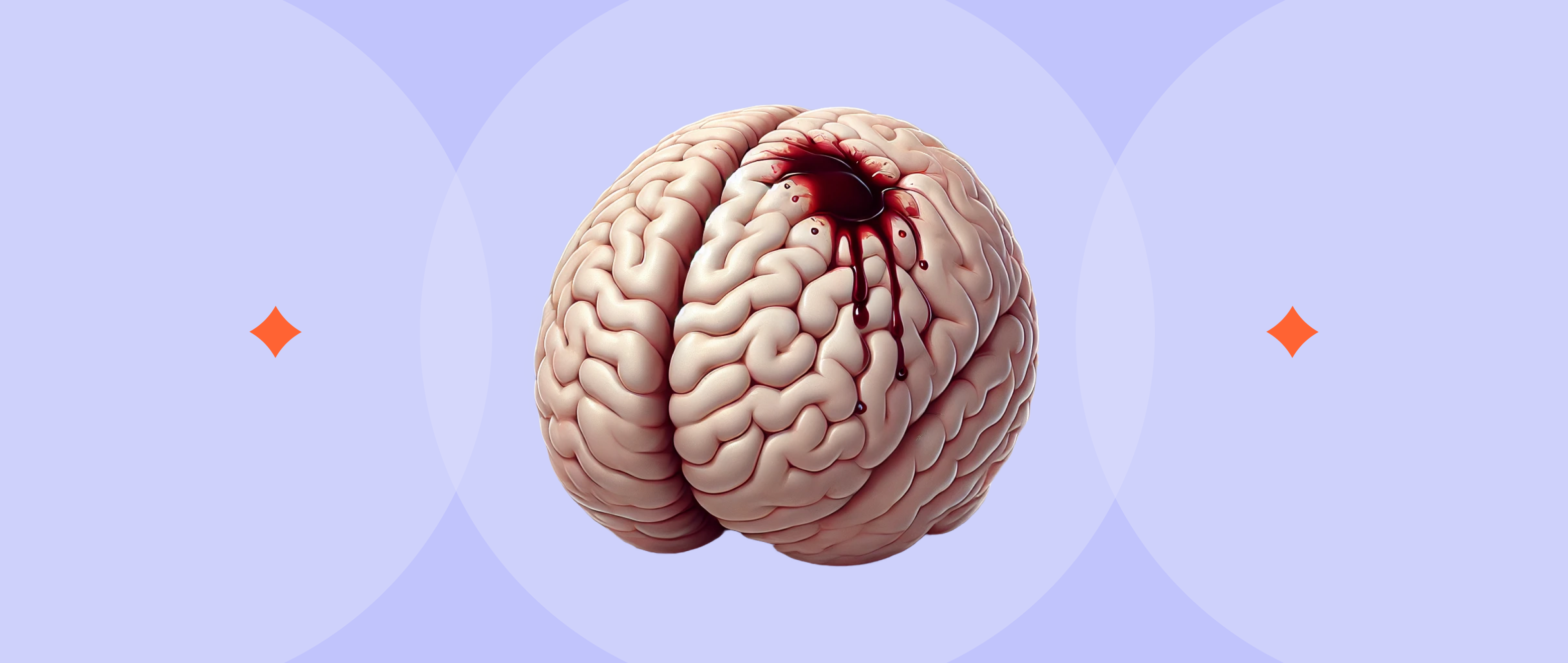 Everyday Bumps and the Brain: A Look at Subdural Haematomas
