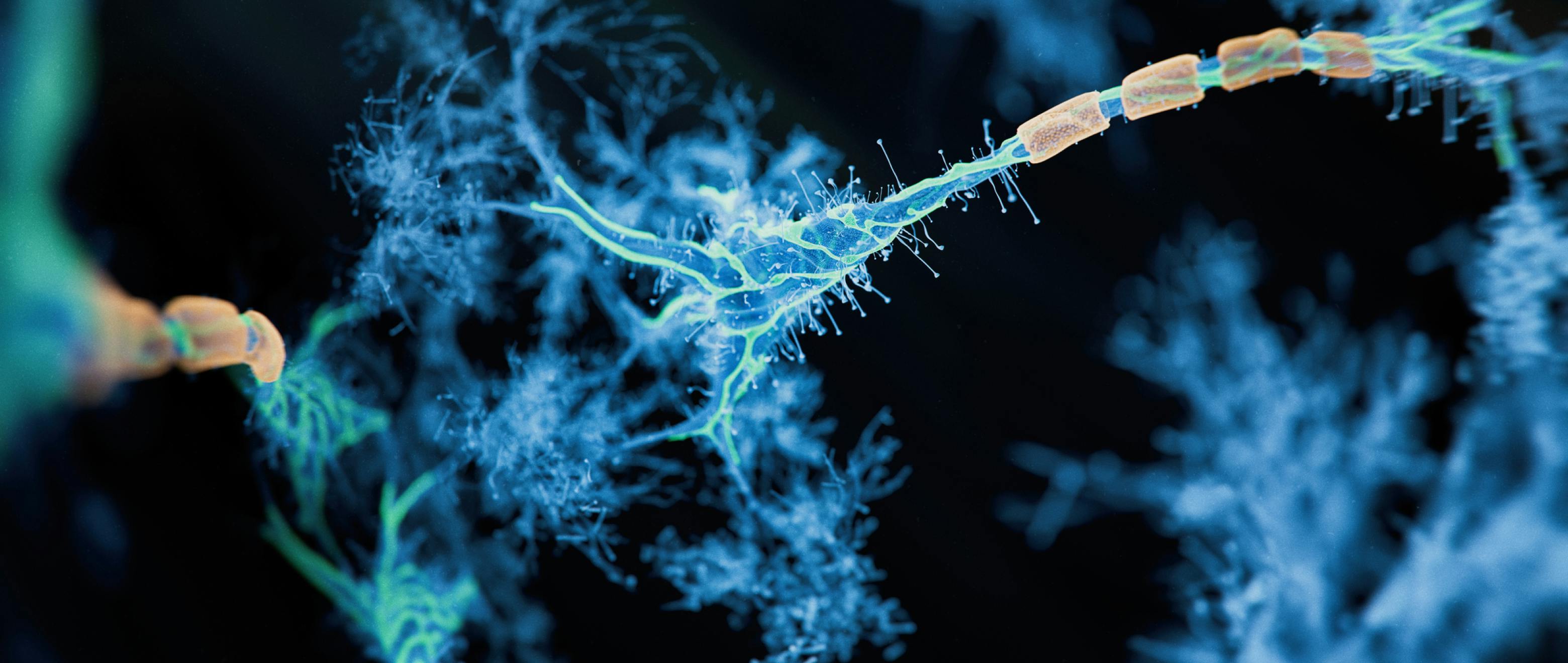 The Science Behind the Glitchy Wiring of Multiple Sclerosis