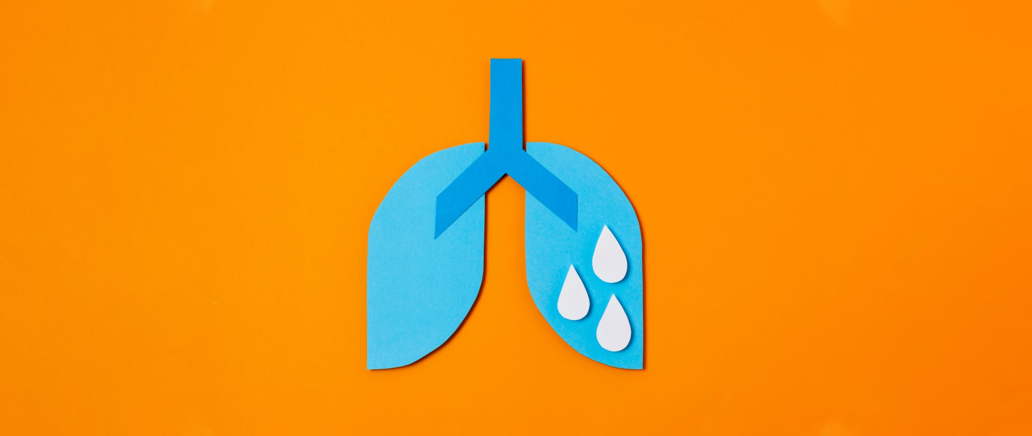 Pleural Effusion: When Your Lungs Throw a Pool Party