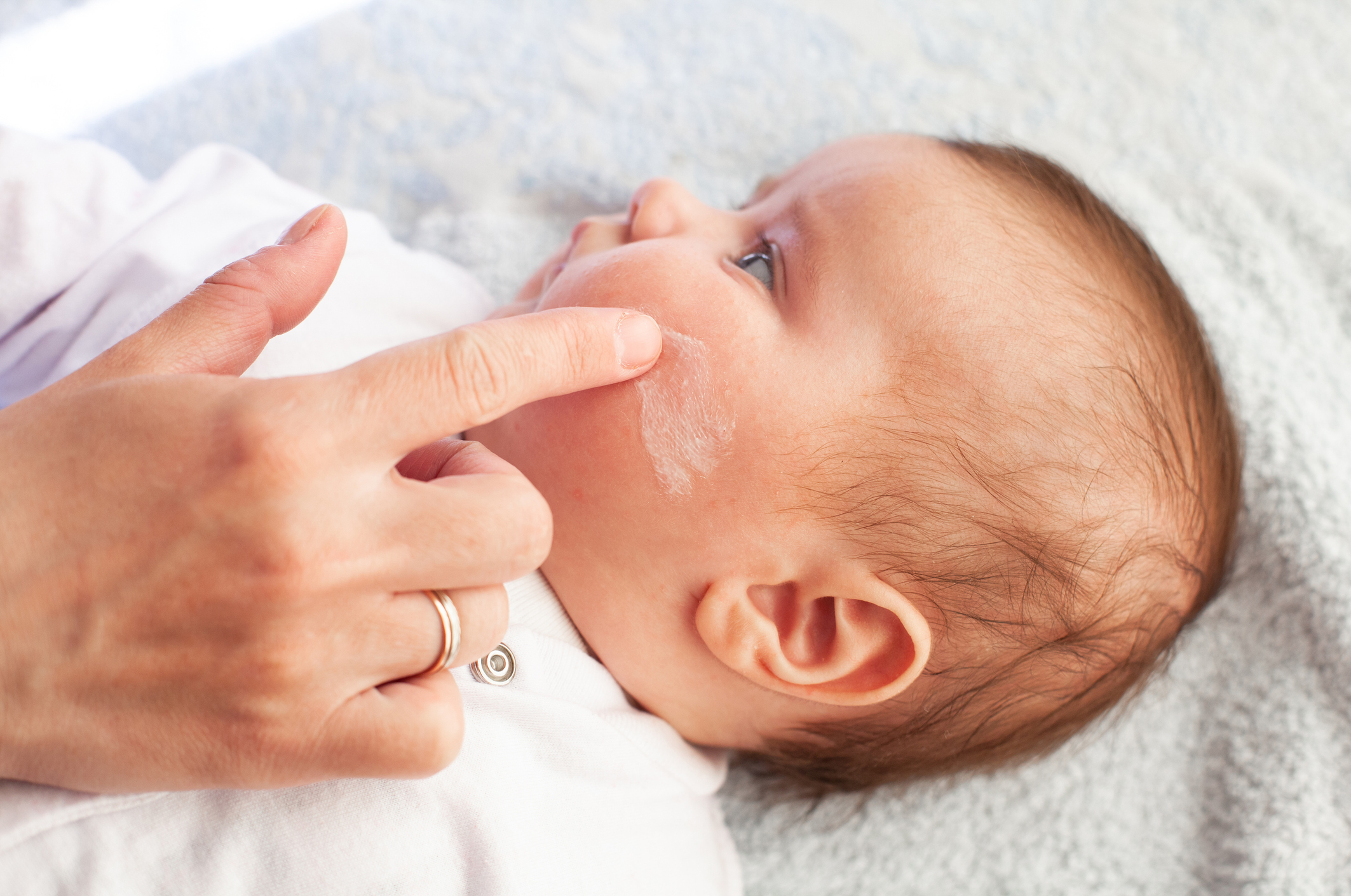 Baby Skin Allergy: Types, Causes, Symptoms, and Safe Treatment Options