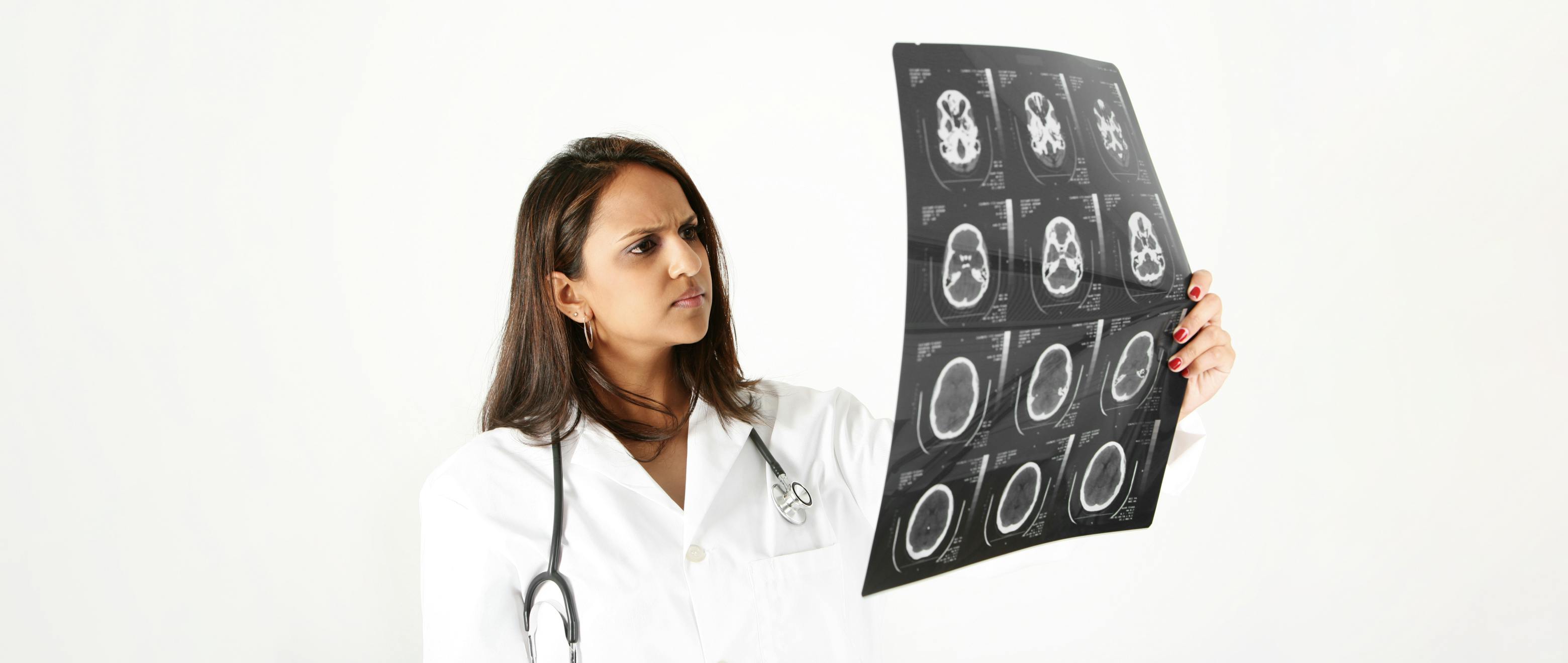 Head Start: Spot the Early Signs of Brain Tumours Before They Take Over