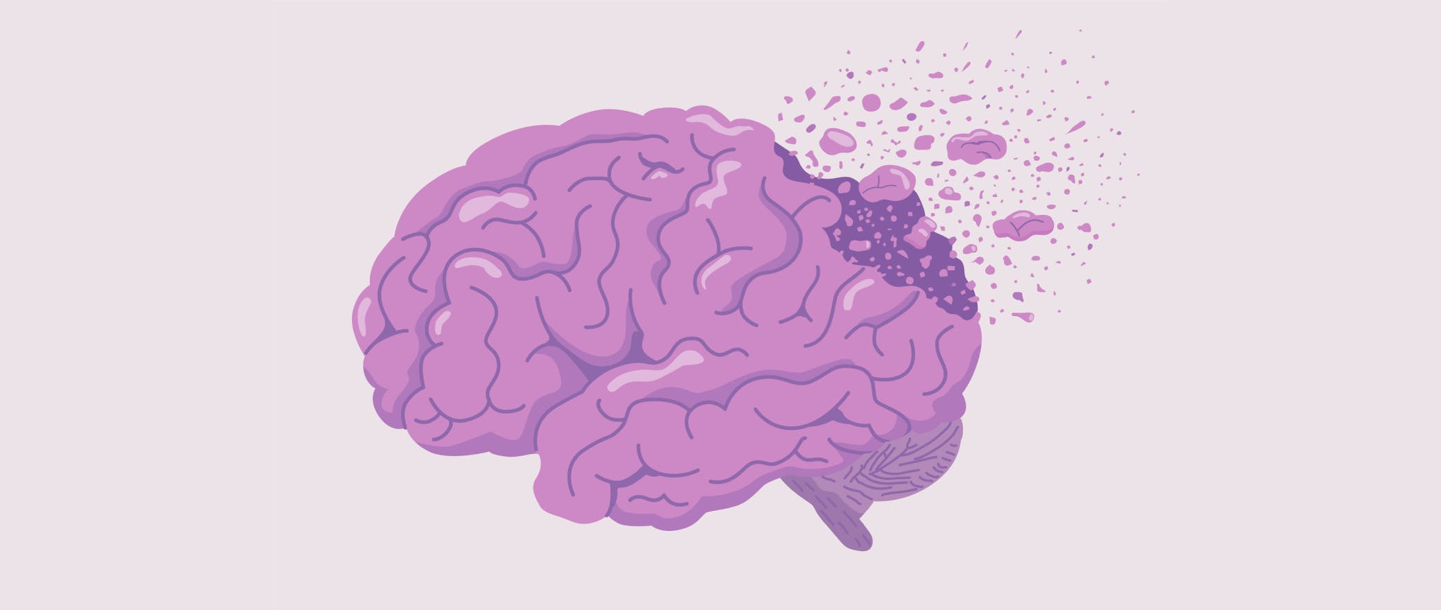 Dementia Isn't Inevitable: Take Charge of Your Brain Health