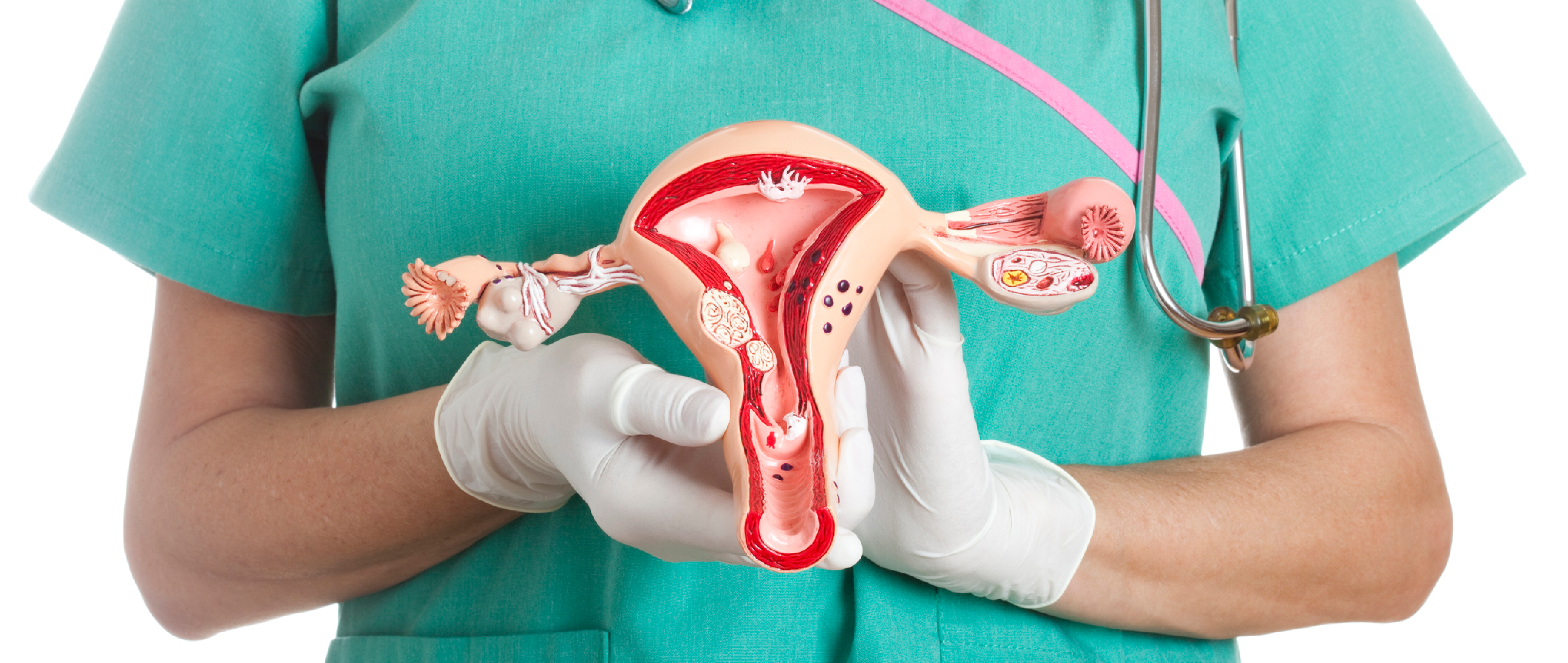 Cervical Cancer: Causes, Symptoms, and Prevention