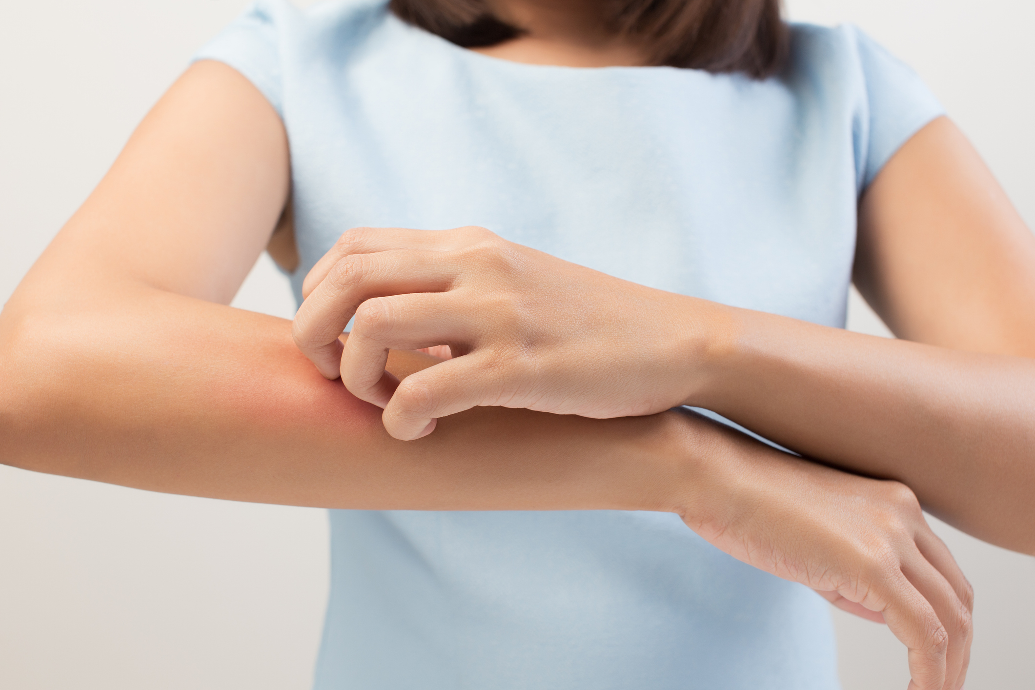 What is Pruritus? Causes, Symptoms & Relief Expert Guide