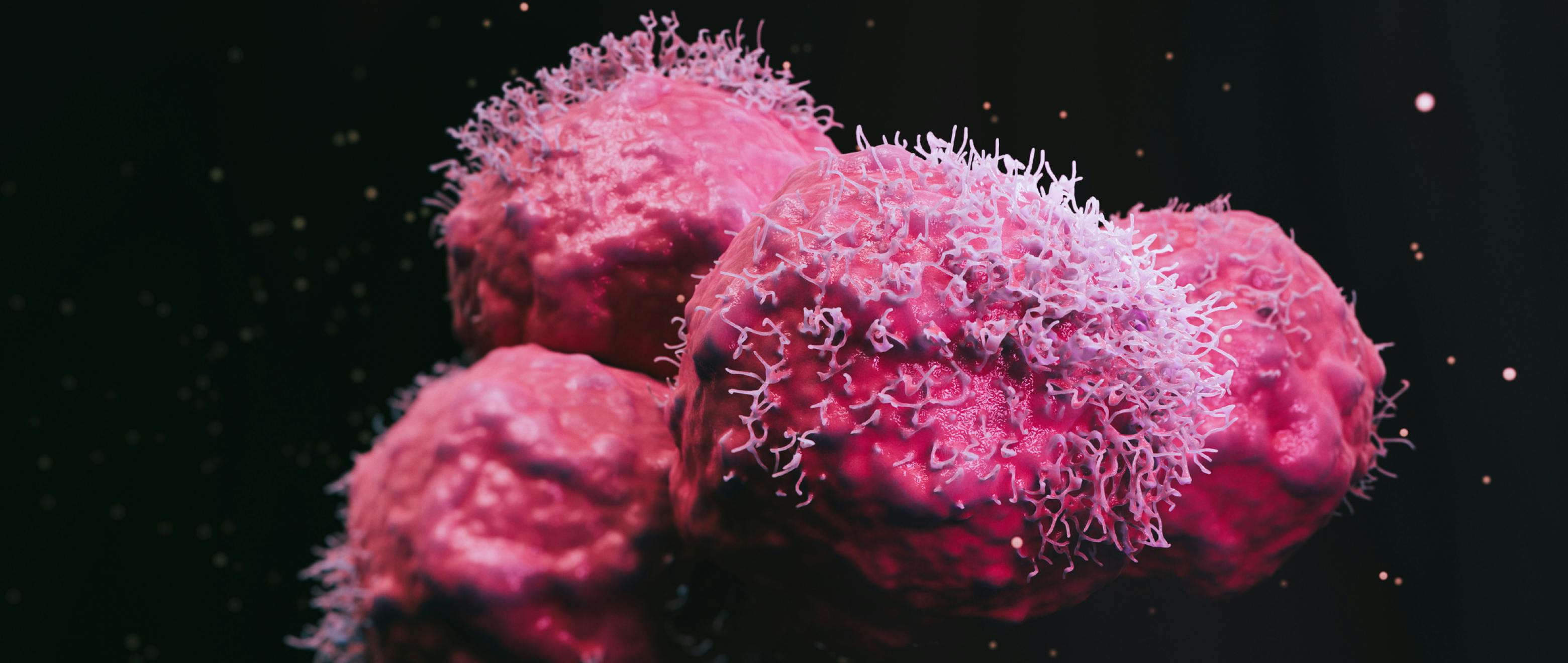 Relax, It Isn’t Cancer: Here’s All You Need to Know About Benign Tumours
