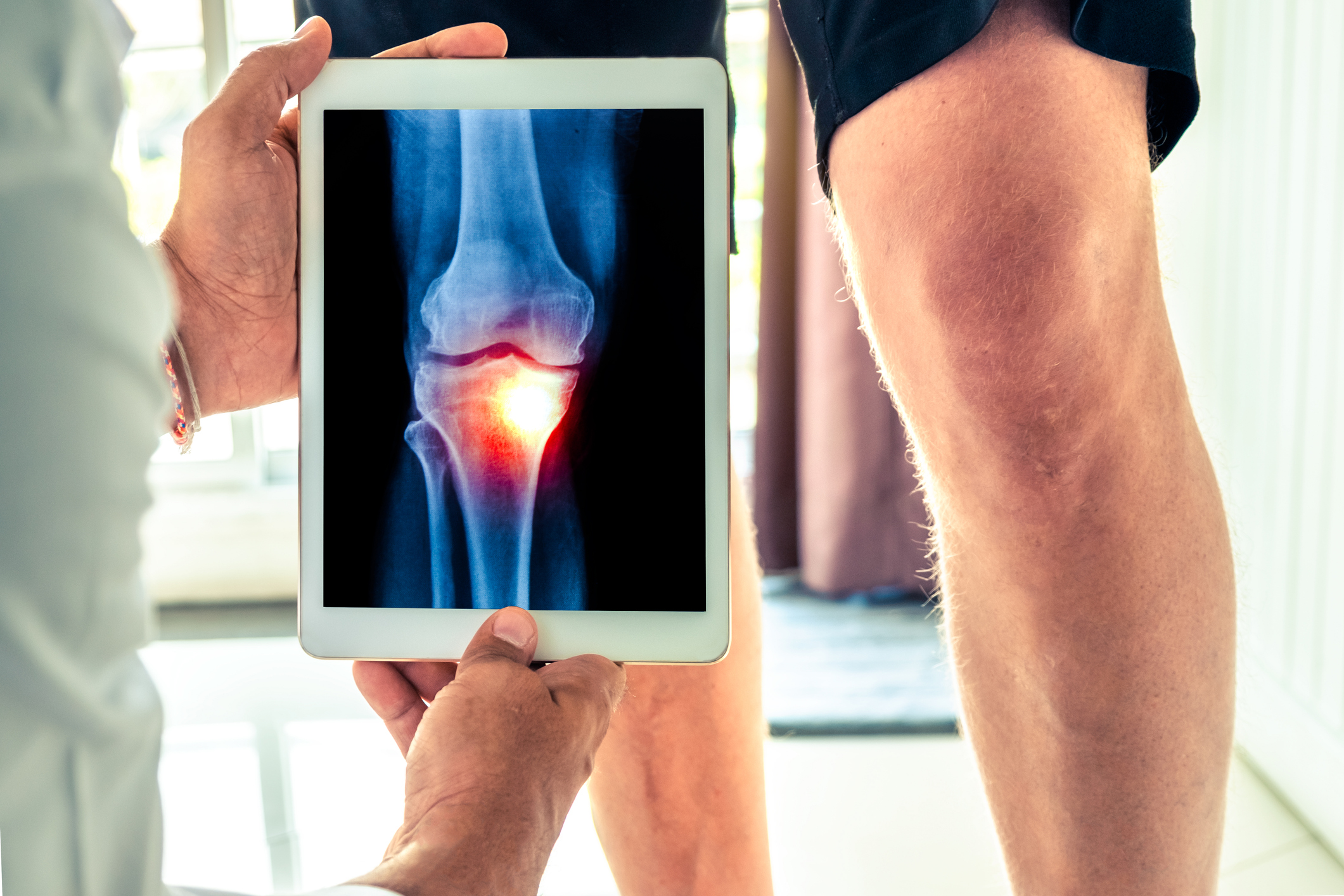 Arthritis: Are Your Joints Feeling a Little Rusty Lately?
