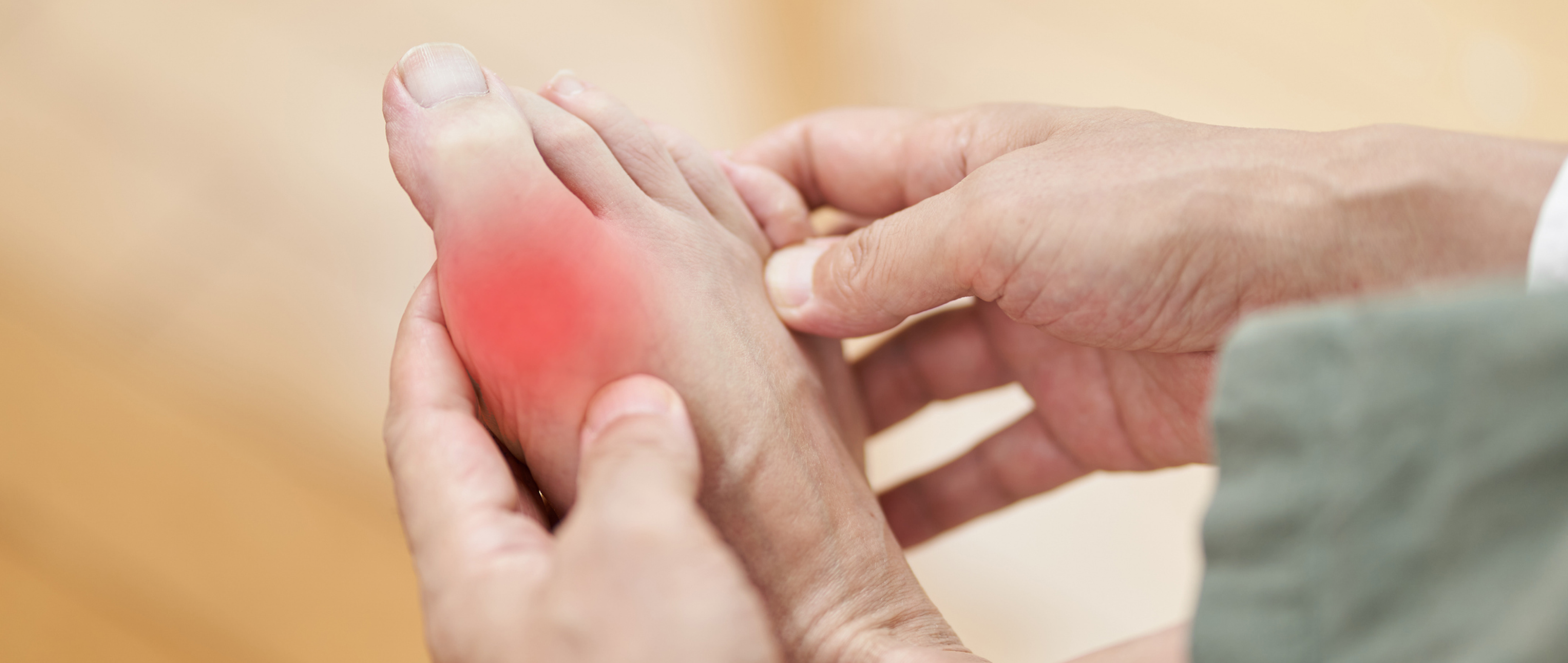 Toe-tally Painful: The Gout Story                        