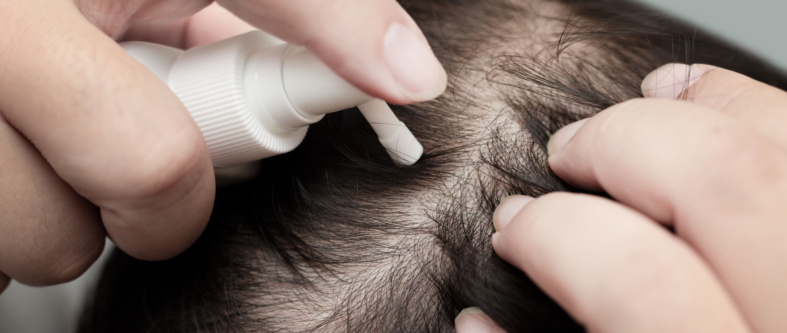 Zinc About It: Your Way to Thicker, Stronger & Healthier Hair