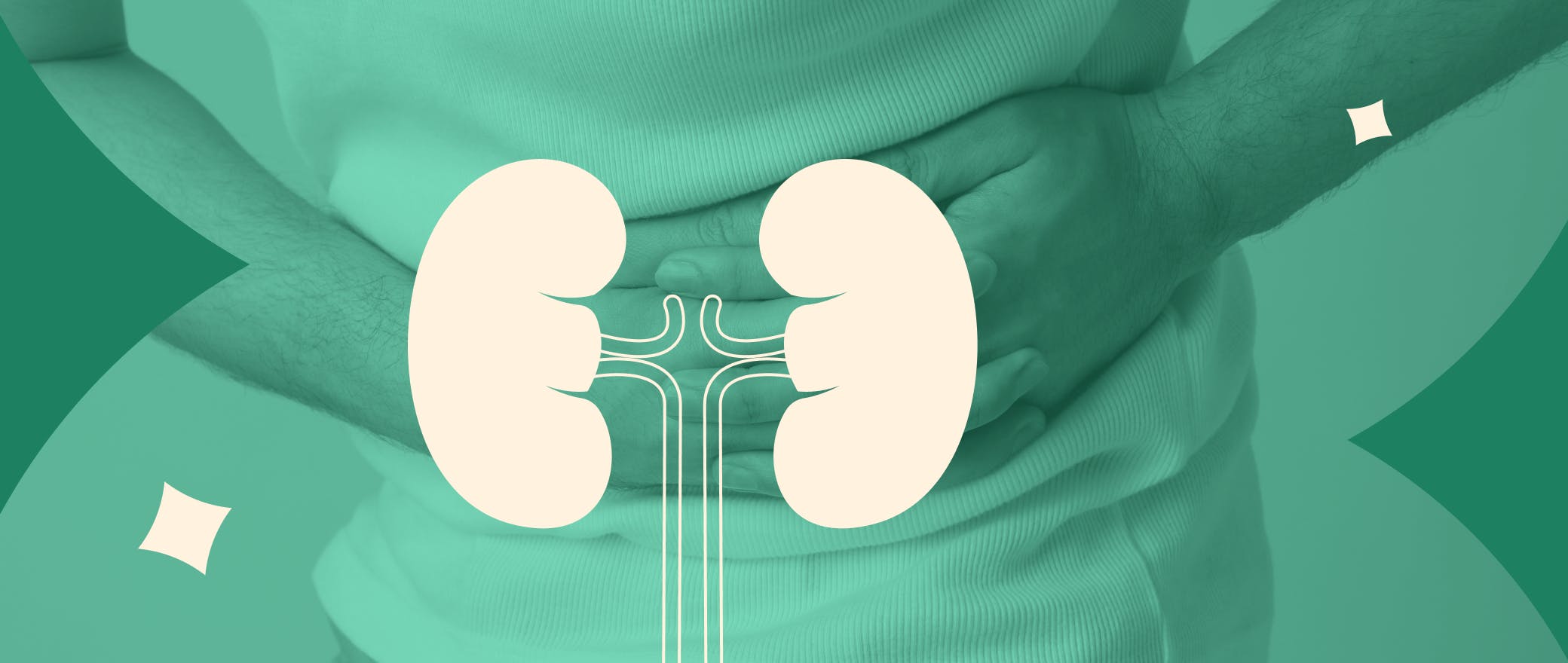 Stoned: Everything You Need to Know About Kidney Stones